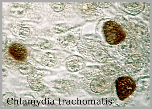 Chlamydia  Amstelveen