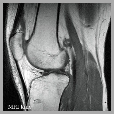 MRI Amstelveen