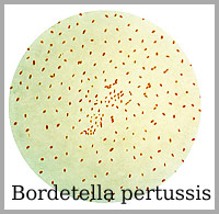 Bordetella Amstelveen